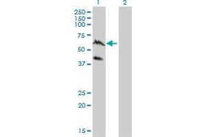 Western Blot analysis of PPIL4 expression in transfected 293T cell line by PPIL4 monoclonal antibody (M01), clone 1C10.
