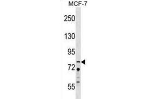 Western Blotting (WB) image for anti-Zinc Finger Protein 828 (ZNF828) antibody (ABIN2999729) (ZNF828 antibody)