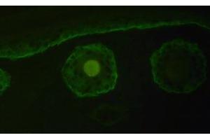 Immunofluorescence staining of Collagen type XVII alpha 1 chain with Cat. (COL17A1 antibody  (Chain alpha 1))