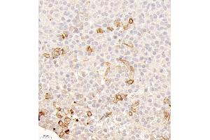 Immunohistochemistry of paraffin embedded mouse hypophysis using Galanin (ABIN7074010) at dilution of 1:500 (400x lens) (Galanin antibody)