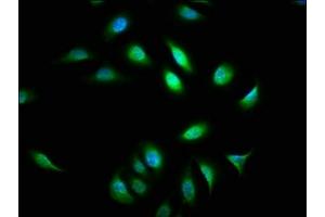 Immunofluorescence staining of A549 cells with ABIN7144797 at 1:133, counter-stained with DAPI. (ATXN7 antibody  (AA 402-503))