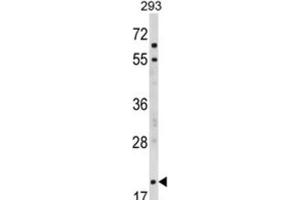 Western Blotting (WB) image for anti-Myelin Associated Oligodendrocyte Basic Protein (MOBP) antibody (ABIN3002875) (MOBP antibody)