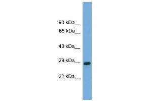 WB Suggested Anti-RGS19 Antibody Titration: 0. (RGS19 antibody  (N-Term))