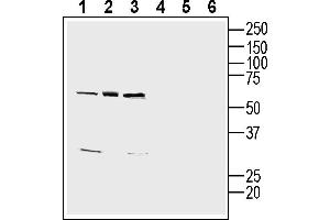 Western blot analysis of human  monocytic leukemia cell line lysates (lanes 1 and 4), human  megakaryoblast cell line lysate (lanes 2 and 5) and human LNCaP prostate adenocarcinoma cell line lysate (lanes 3 and 6):1-3. (CD9 antibody  (Extracellular))