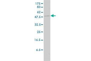 KRT23 antibody  (AA 1-422)
