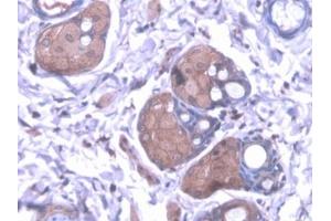 Detection of KMO in Rat Skin Tissue using Polyclonal Antibody to Kynurenine-3-Monooxygenase (KMO) (KMO antibody  (AA 1-282))