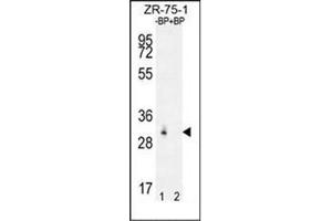 Western blot analysis of RAB40AL Antibdy (N-term) Cat. (RAB40AL antibody  (N-Term))