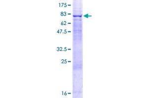 PRPF4 Protein (AA 1-522) (GST tag)