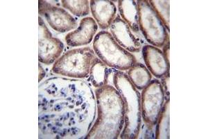 anti-DnaJ (Hsp40) Homolog, Subfamily C, Member 27 (DNAJC27) (AA 1-30), (N-Term) antibody