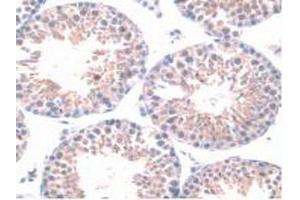 Detection of HPSE in Mouse Testis Tissue using Polyclonal Antibody to Heparanase (HPSE) (HPSE antibody  (AA 280-412))