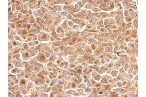 IHC-P Image KLRC1 antibody [N1N2], N-term detects KLRC1 protein at cytosol on H1299 xenograft by immunohistochemical analysis. (KLRC1 antibody  (N-Term))