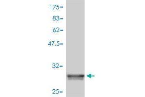 Western Blot detection against Immunogen (30. (ZDHHC8 antibody  (AA 1-42))