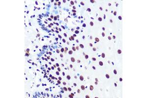 Immunohistochemistry of paraffin-embedded human esophageal using P Rabbit mAb (ABIN7269445) at dilution of 1:100 (40x lens). (PABPN1 antibody)