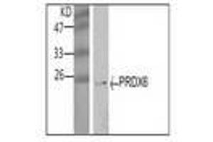 Image no. 1 for anti-Peroxiredoxin 6 (PRDX6) antibody (ABIN791528) (Peroxiredoxin 6 antibody)