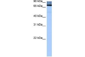 Human Liver; WB Suggested Anti-ADAD2 Antibody Titration: 0. (ADAD2 antibody  (Middle Region))