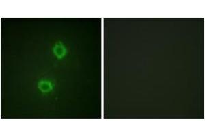 Immunofluorescence analysis of HuvEc cells, using FGFR1 (Ab-654) Antibody. (FGFR1 antibody  (AA 626-675))