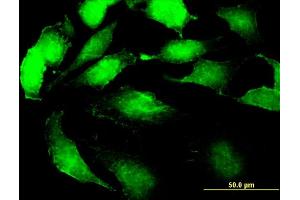 Immunofluorescence of monoclonal antibody to SSR2 on HeLa cell. (SSR2 antibody  (AA 51-150))