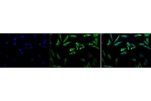 Immunocytochemistry/Immunofluorescence analysis using Mouse Anti-Hsp27 Monoclonal Antibody, Clone 5D12-A3 (ABIN361649 and ABIN361650). (HSP27 antibody)