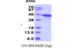 SDS-PAGE (SDS) image for Aldo-Keto Reductase Family 1, Member C3 (3-alpha Hydroxysteroid Dehydrogenase, Type II) (AKR1C3) (AA 1-323), (Isoform 1) (Active) protein (ABIN6387733)