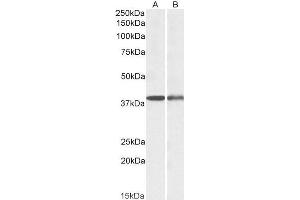 Western Blotting (WB) image for anti-Capping Protein (Actin Filament), Gelsolin-Like (CAPG) (AA 205-217) antibody (ABIN5927115)