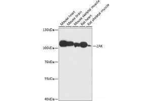 Western blot analysis of extracts of various cell lines using ZAK Polyclonal Antibody at dilution of 1:3000. (ZAK antibody)