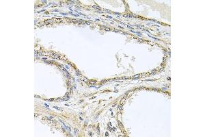 Immunohistochemistry of paraffin-embedded human prostate using TNFRSF10A antibody (ABIN5973697) at dilution of 1/100 (40x lens). (TNFRSF10A antibody)
