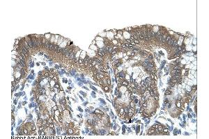 RARRES3 antibody was used for immunohistochemistry at a concentration of 4-8 ug/ml. (RARRES3 antibody)