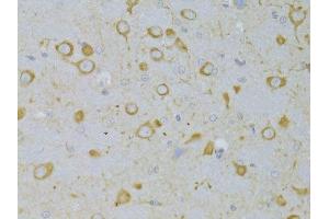 Immunohistochemistry of paraffin-embedded rat brain using TSHR Antibody. (TSH receptor antibody  (AA 21-253))