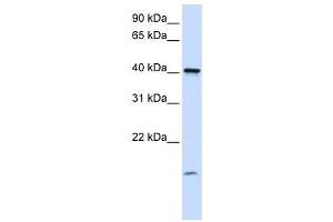 Western Blotting (WB) image for anti-Transmembrane Protein 79 (TMEM79) antibody (ABIN2459356) (TMEM79 antibody)