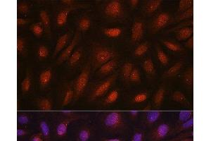 Immunofluorescence analysis of U2OS cells using CETN3 Polyclonal Antibody at dilution of 1:100. (CETN3 antibody)