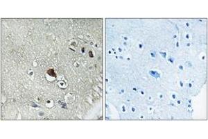Immunohistochemistry analysis of paraffin-embedded human brain tissue, using DVL3 Antibody. (DVL3 antibody  (AA 326-375))