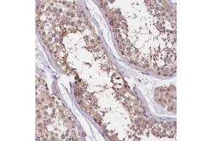 Immunohistochemical staining of human testis with UBXN6 polyclonal antibody  shows strong cytoplasmic positivity in spermatids.