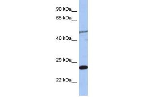 MIS12 antibody used at 1 ug/ml to detect target protein.