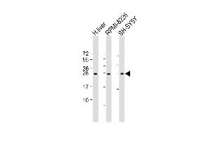 Western Blot at 1:2000 dilution Lane 1: human liver lysate Lane 2: RPMI-8226 whole cell lysate Lane 3: SH-SY5Y lysate Lysates/proteins at 20 ug per lane.