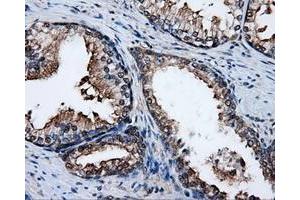 Immunohistochemical staining of paraffin-embedded liver tissue using anti-PSMC3mouse monoclonal antibody. (PSMC3 antibody)