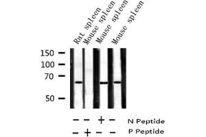 Western blot analysis of Phospho-ZAP-70 (Tyr319) expression in various lysates (ZAP70 antibody  (pTyr319))