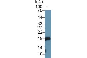 Western Blot; Sample: Mouse Stomach lysate; Primary Ab: 1µg/ml Rabbit Anti-Rat GKN1 Antibody Second Ab: 0. (Gastrokine 1 antibody  (AA 27-151))