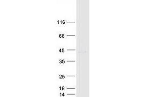 Western Blotting (WB) image for SRY (Sex Determining Region Y)-Box 1 (SOX1) protein (Myc-DYKDDDDK Tag) (ABIN2732429)