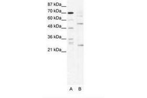 Image no. 1 for anti-T-Cell Acute Lymphocytic Leukemia 1 (TAL1) (AA 236-285) antibody (ABIN202266) (TAL1 antibody  (AA 236-285))