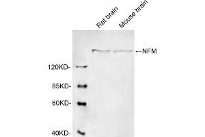 Western blot analysis of cell lysates using 1 µg/mL Rabbit Anti-Neurofilament-M Polyclonal Antibody (ABIN398865) The signal was developed with IRDyeTM 800 Conjugated Goat Anti-Rabbit IgG. (NEFM antibody  (AA 320-370))