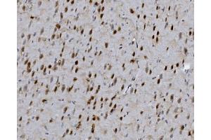 anti-Forkhead Box P1 (FOXP1) (C-Term) antibody