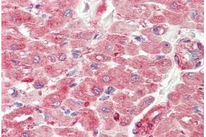 Human Heart: Formalin-Fixed, Paraffin-Embedded (FFPE) (TWEAK antibody  (Pro73))