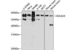 Western blot analysis of extracts of various cell lines, using GOLG antibody (ABIN6129790, ABIN6141266, ABIN6141267 and ABIN6214379) at 1:1000 dilution.
