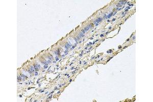 Immunohistochemistry of paraffin-embedded Human trachea using EPOR Polyclonal Antibody at dilution of 1:100 (40x lens).