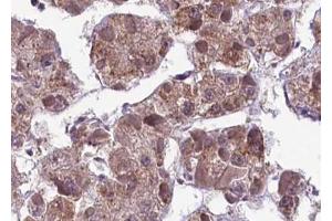 ABIN6267593 at 1/100 staining human liver tissue sections by IHC-P. (MEK1 antibody  (pSer217))