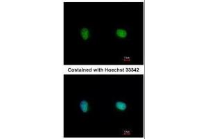 ICC/IF Image Immunofluorescence analysis of paraformaldehyde-fixed HeLa, using Ku70, antibody at 1:500 dilution. (XRCC6 antibody)