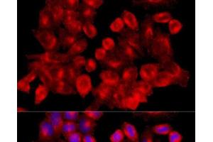 Immunofluorescence analysis of HeLa cells using CLTC Polyclonal Antibody at dilution of 1:100 (40x lens). (Clathrin Heavy Chain (CLTC) antibody)