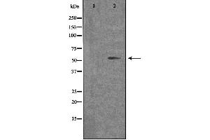 Western blot analysis of extracts from COLO cells, using OPN4 antibody. (OPN4 antibody  (C-Term))