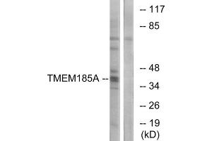 Western blot analysis of extracts from K562 cells, using TMEM185A antibody. (TMEM185A antibody  (C-Term))