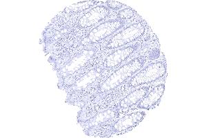 Rectum mucosa (Recombinant Melanoma gp100 antibody)